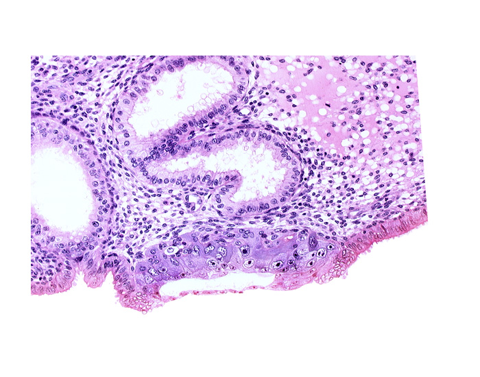 blastocystic cavity (blastocoele), cytotrophoblast, edematous endometrial stroma (decidua), endometrial epithelium, membranous trophoblast at abembryonic pole, solid syncytiotrophoblast, uterine cavity