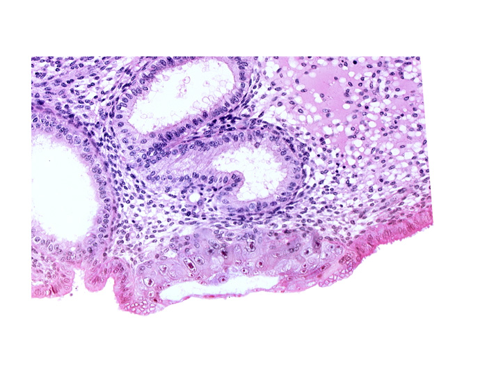 blastocystic cavity (blastocoele), cytotrophoblast, edge of amniotic cavity, edge of embryonic disc, lumen of endometrial gland, membranous trophoblast at abembryonic pole, solid syncytiotrophoblast