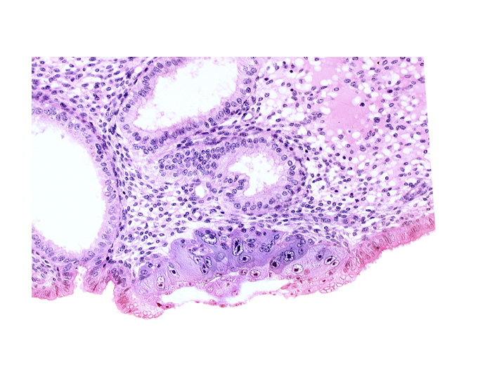 amnioblast(s), amniotic cavity, endometrial sinusoid, epiblast, extra-embryonic mesoblast, hypoblast, membranous trophoblast at abembryonic pole