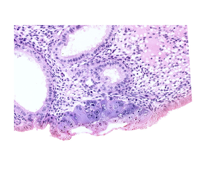amniotic cavity, blastocystic cavity (blastocoele), cytotrophoblast, edematous endometrial stroma (decidua), endometrial epithelium, endometrial gland, endometrial sinusoid, lumen of endometrial gland, solid syncytiotrophoblast
