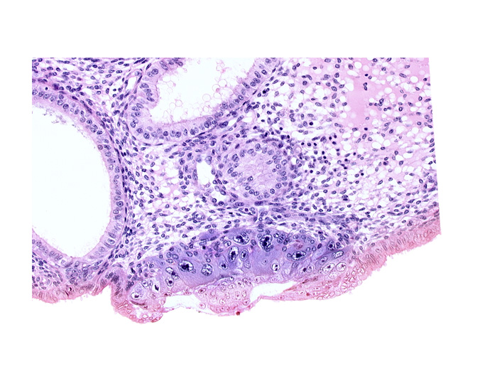 amnioblast(s), blastocystic cavity (blastocoele), cytotrophoblast, embryonic disc, endometrial sinusoid, lumen of endometrial gland, membranous trophoblast at abembryonic pole, solid syncytiotrophoblast, uterine cavity