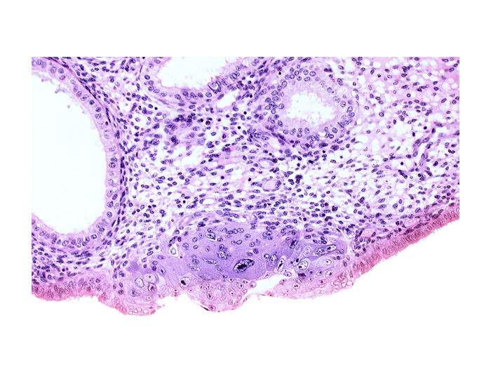 blastocystic cavity (blastocoele), cytotrophoblast, edematous endometrial stroma (decidua), edge of endometrial gland, embryonic disc, endometrial epithelium, membranous trophoblast at abembryonic pole, solid syncytiotrophoblast, syncytiotrophoblast / decidua interface