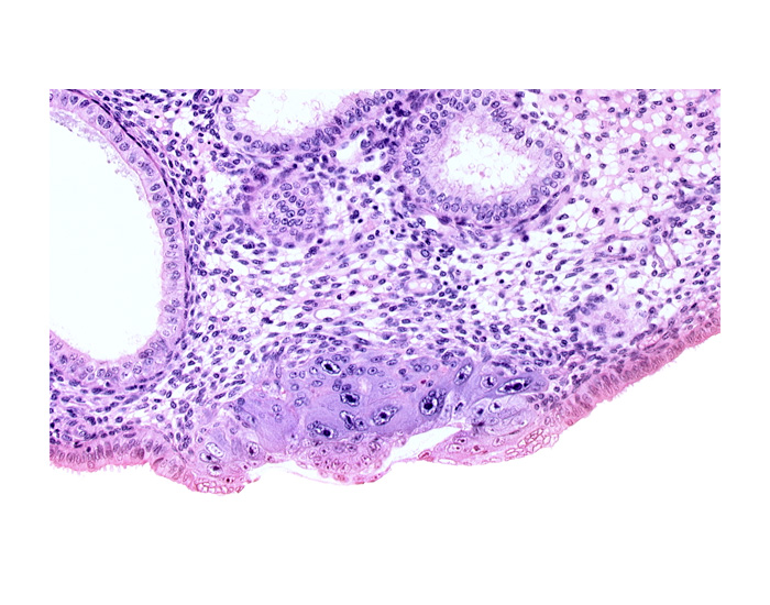 blastocystic cavity (blastocoele), edge of endometrial sinusoid, embryonic disc, endometrial gland, membranous trophoblast at abembryonic pole, solid syncytiotrophoblast, uterine cavity