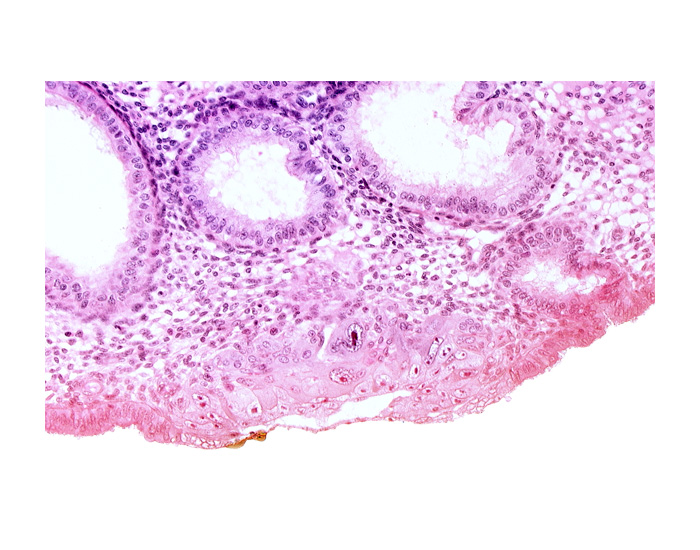 blastocystic cavity (blastocoele), cytotrophoblast, edematous endometrial stroma (decidua), edge of endometrial gland, embryonic disc, endometrial sinusoid, membranous trophoblast at abembryonic pole, solid syncytiotrophoblast, syncytiotrophoblast / decidua interface