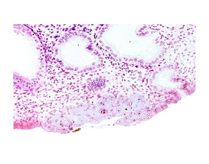 blastocystic cavity (blastocoele), edge of embryonic disc, endometrial epithelium, lumen of endometrial gland, membranous trophoblast at abembryonic pole, mouth of endometrial gland, solid syncytiotrophoblast