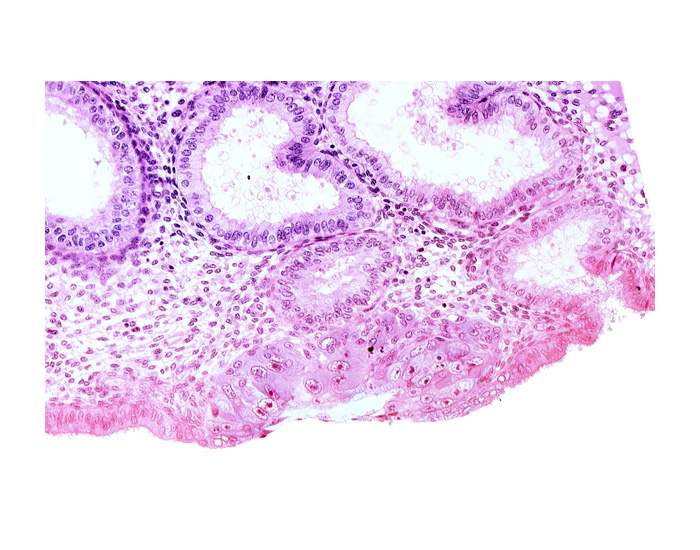 blastocystic cavity (blastocoele), endometrial epithelium, endometrial gland, membranous trophoblast at abembryonic pole, mouth of endometrial gland