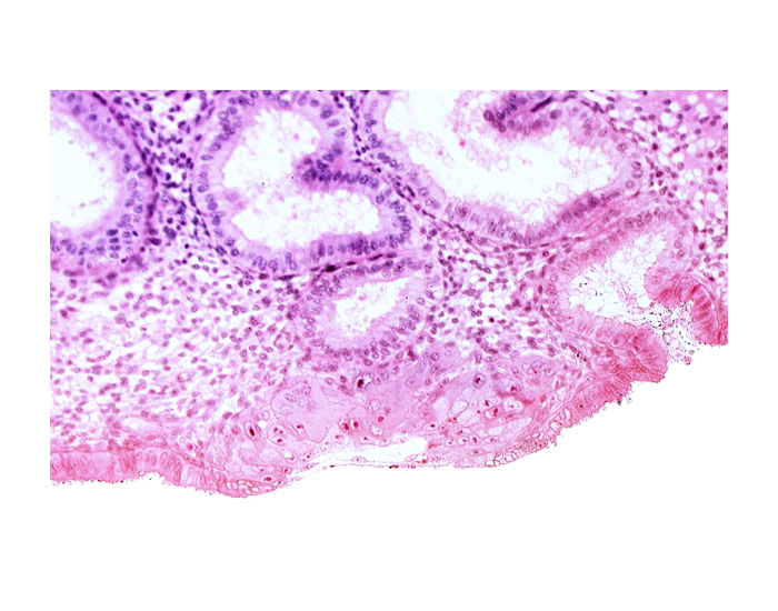 blastocystic cavity (blastocoele), chorion, cytotrophoblast, extra-embryonic mesoblast, lumen of endometrial gland, mouth of endometrial gland, solid syncytiotrophoblast