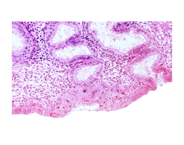 blastocystic cavity (blastocoele), cytotrophoblast, junction of endometrial gland and syncytiotrophoblast, lumen of endometrial gland, membranous trophoblast at abembryonic pole, solid syncytiotrophoblast