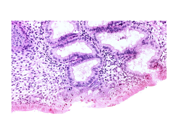 blastocystic cavity (blastocoele), endometrial epithelium, endometrial gland, endometrial sinusoid, membranous trophoblast at abembryonic pole, solid syncytiotrophoblast, space(s) within syncytiotrophoblast