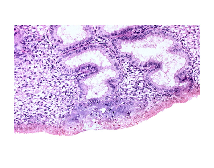 cytotrophoblast, edge of blastocystic cavity (blastocoele), endometrial gland, endometrial sinusoid, extra-embryonic mesoblast, membranous trophoblast at abembryonic pole, space(s) within syncytiotrophoblast