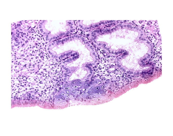 cytotrophoblast, edematous endometrial stroma (decidua), endometrial epithelium, endometrial gland, endometrial sinusoid, membranous trophoblast at abembryonic pole, solid syncytiotrophoblast