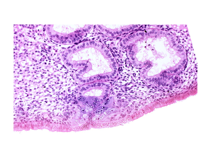 cytotrophoblast, endometrial epithelium, endometrial gland, endometrial sinusoid, solid syncytiotrophoblast, uterine cavity