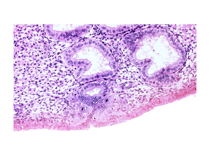 cytotrophoblast, endometrial epithelium, endometrial gland, endometrial sinusoid, solid syncytiotrophoblast, uterine cavity