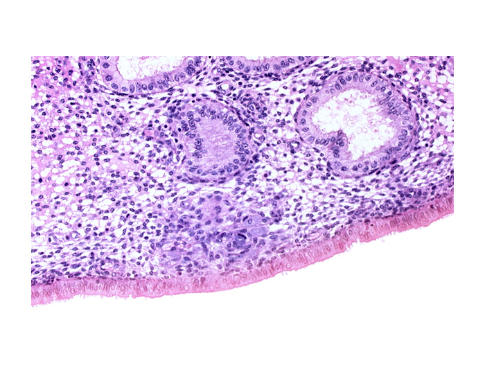 edematous endometrial stroma (decidua), endometrial epithelium, endometrial gland, endometrial sinusoid, lumen of endometrial gland, solid syncytiotrophoblast