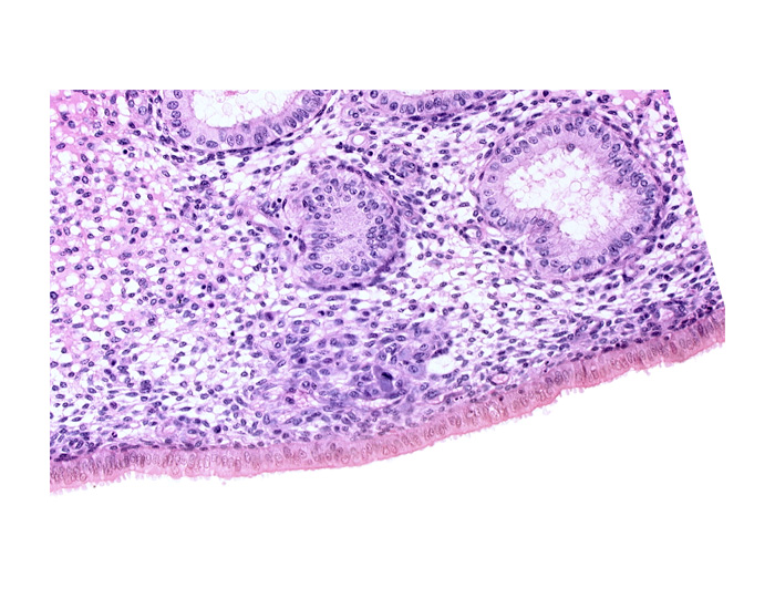 edematous endometrial stroma (decidua), endometrial epithelium, endometrial gland, endometrial sinusoid, lumen of endometrial gland, solid syncytiotrophoblast, uterine cavity