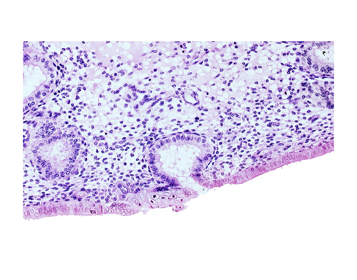 endometrial epithelium, lumen of endometrial gland, mouth of endometrial gland, solid syncytiotrophoblast