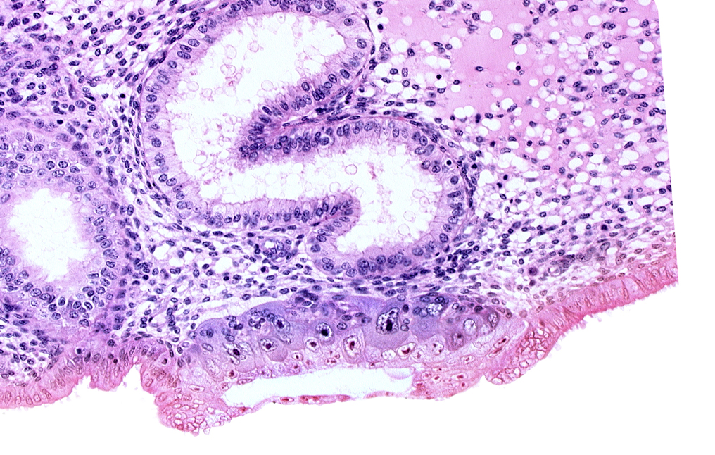 blastocystic cavity (blastocoele), endometrial epithelium, extra-embryonic mesoblast, lumen of endometrial gland, solid syncytiotrophoblast, trophoblast