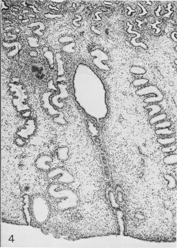 Tissues at and near implantation site