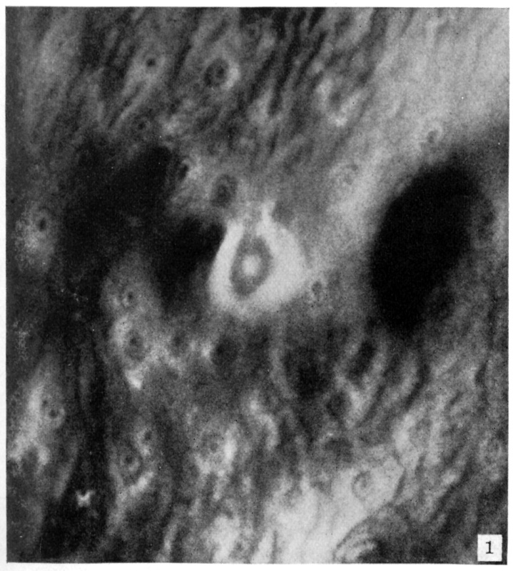 Surface view of implantation site