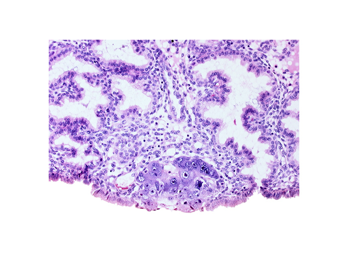 blastocystic cavity (blastocoele), endometrial sinusoid, extra-embryonic mesoblast, membranous trophoblast at abembryonic pole, mouth of adjacent endometrial gland, syncytiotrophoblastic mass