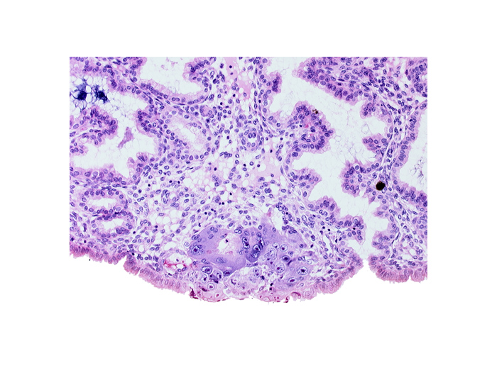 amniotic cavity, blastocystic cavity (blastocoele), edematous endometrial stroma (decidua), membranous trophoblast at abembryonic pole, syncytiotrophoblast / decidua interface, uterine cavity