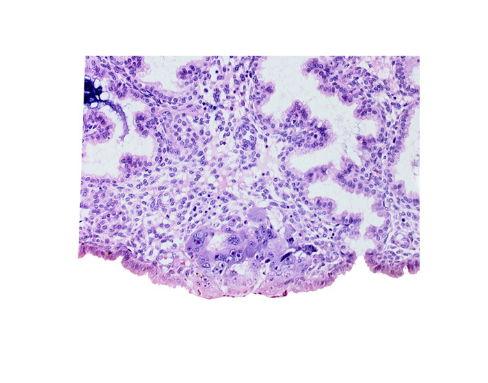 amniotic cavity, blastocystic cavity (blastocoele), epiblast, hypoblast, lumen of endometrial gland, membranous trophoblast at abembryonic pole, mouth of adjacent endometrial gland, solid syncytiotrophoblast