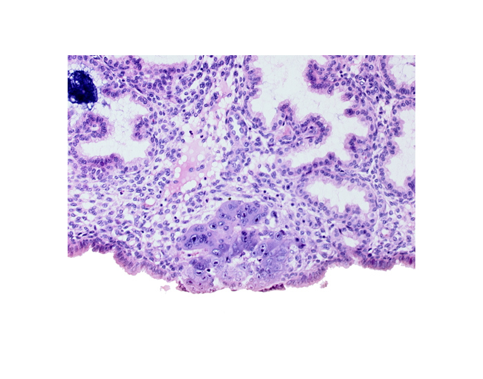 blastocystic cavity (blastocoele), edge of amniotic cavity, epiblast, hypoblast, membranous trophoblast at abembryonic pole, syncytiotrophoblast
