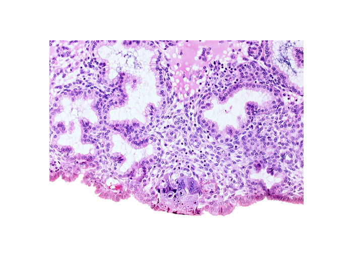 edge of cytotrophoblast, edge of syncytiotrophoblast, uterine cavity