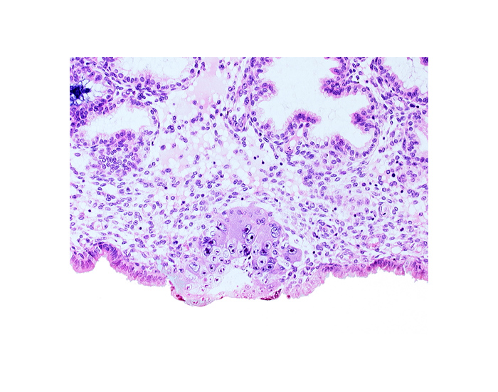 blastocystic cavity (blastocoele), cytotrophoblast, extra-embryonic mesoblast, solid syncytiotrophoblast