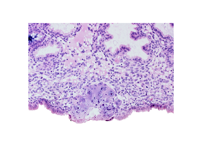 blastocystic cavity (blastocoele), cytotrophoblast, edge of membranous trophoblast at abembryonic pole, solid syncytiotrophoblast