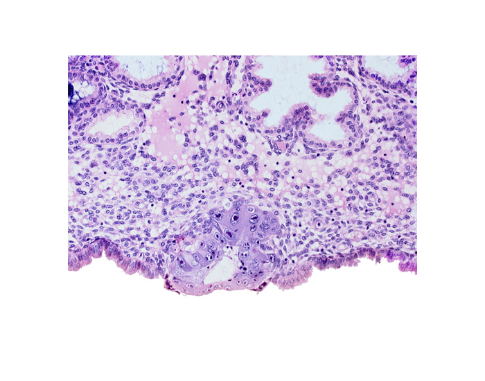 blastocystic cavity (blastocoele), cytotrophoblast, syncytiotrophoblast