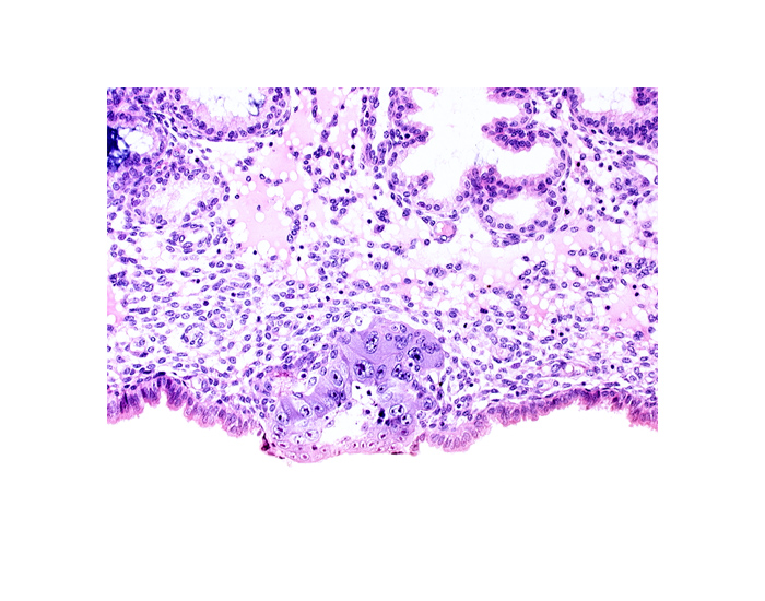blastocystic cavity (blastocoele), cytotrophoblast, syncytiotrophoblast