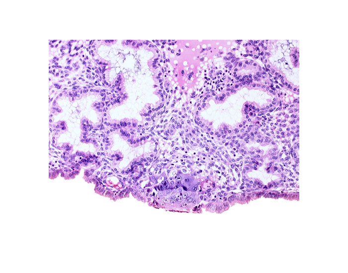 cytotrophoblast, endometrial epithelium, endometrial sinusoid, syncytiotrophoblast