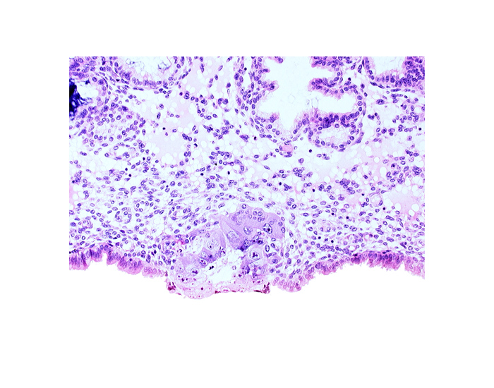 blastocystic cavity (blastocoele), cytotrophoblast, solid syncytiotrophoblast