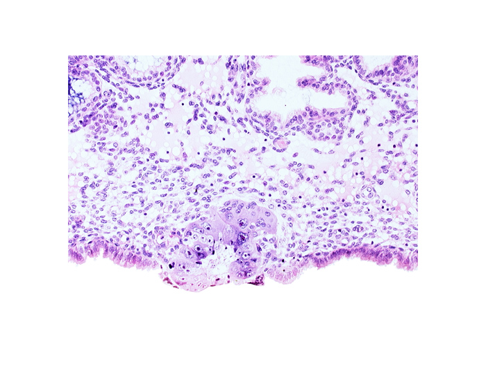 blastocystic cavity (blastocoele), syncytiotrophoblast, syncytiotrophoblast / decidua interface