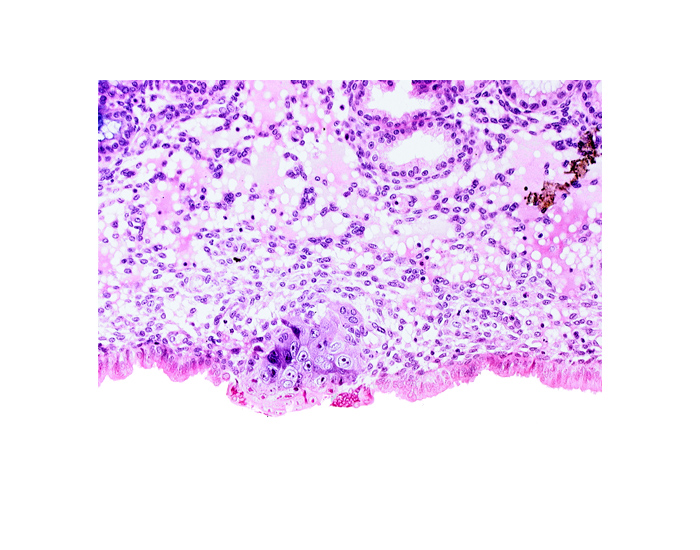cytotrophoblast, edematous endometrial stroma (decidua), endometrial epithelium, endometrial sinusoid, syncytiotrophoblast, uterine cavity