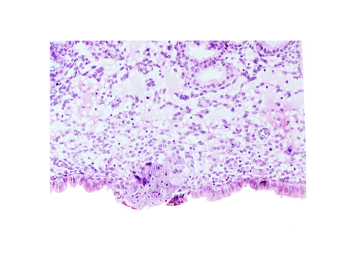 cytotrophoblast, edematous endometrial stroma (decidua), endometrial epithelium, endometrial sinusoid, syncytiotrophoblast / decidua interface, uterine cavity