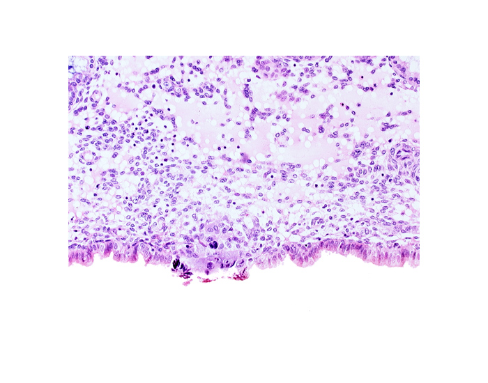 cytotrophoblast, edge of membranous trophoblast at abembryonic pole, uterine cavity