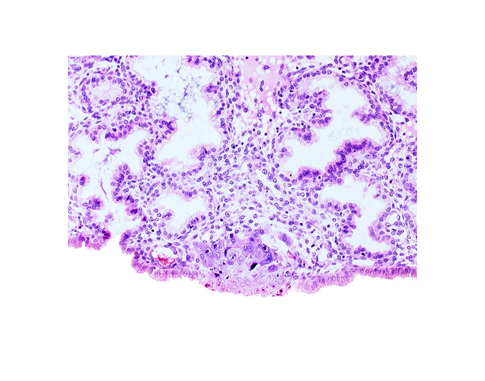 endometrial epithelium, lumen of adjacent endometrial gland, mouth of endometrial gland, solid syncytiotrophoblast