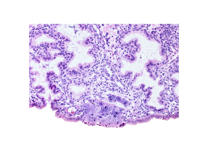 cytotrophoblast, edge of blastocystic cavity (blastocoele), endometrial sinusoid, lumen of adjacent endometrial gland, mouth of adjacent endometrial gland, syncytiotrophoblast, syncytiotrophoblastic mass