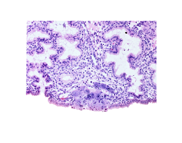 blastocystic cavity (blastocoele), cytotrophoblast, edge of membranous trophoblast at abembryonic pole, endometrial sinusoid, syncytiotrophoblastic mass