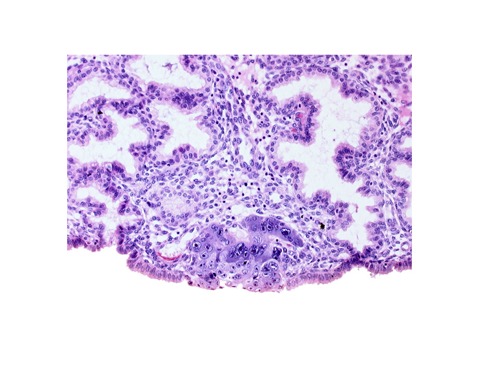 blastocystic cavity (blastocoele), endometrial epithelium, endometrial sinusoid, membranous trophoblast at abembryonic pole, syncytiotrophoblastic mass, uterine cavity