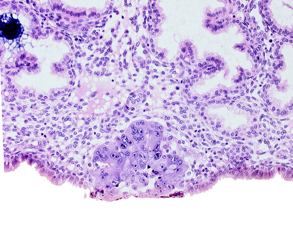 blastocystic cavity (blastocoele), epiblast, hypoblast, syncytiotrophoblast