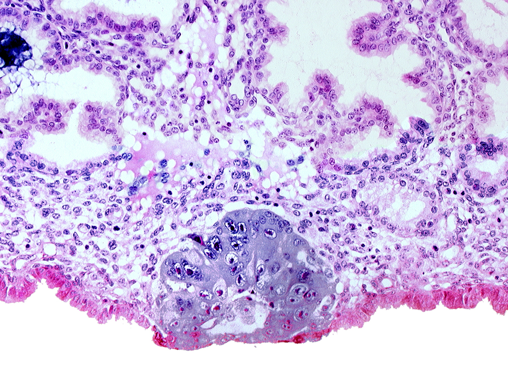 blastocystic cavity (blastocoele), embryonic disc, membranous trophoblast at abembryonic pole, solid syncytiotrophoblast