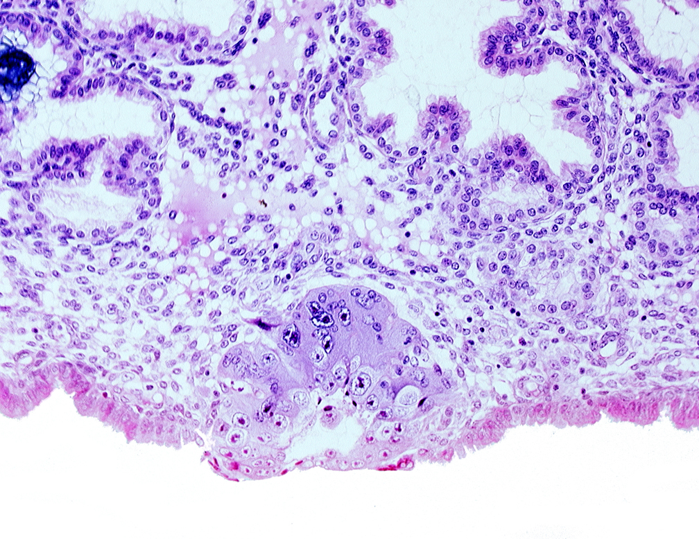 blastocystic cavity (blastocoele), cytotrophoblast, embryonic disc, membranous trophoblast at abembryonic pole, solid syncytiotrophoblast