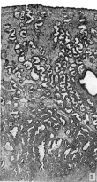 Low-power view of endometrium