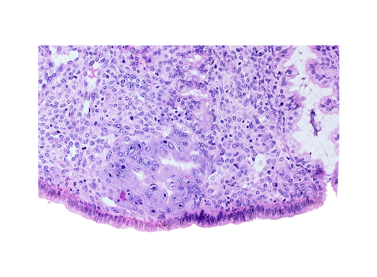 endometrial sinusoid, intact endometrial epithelium, syncytiotrophoblast, trophoblast lacunae, uterine cavity