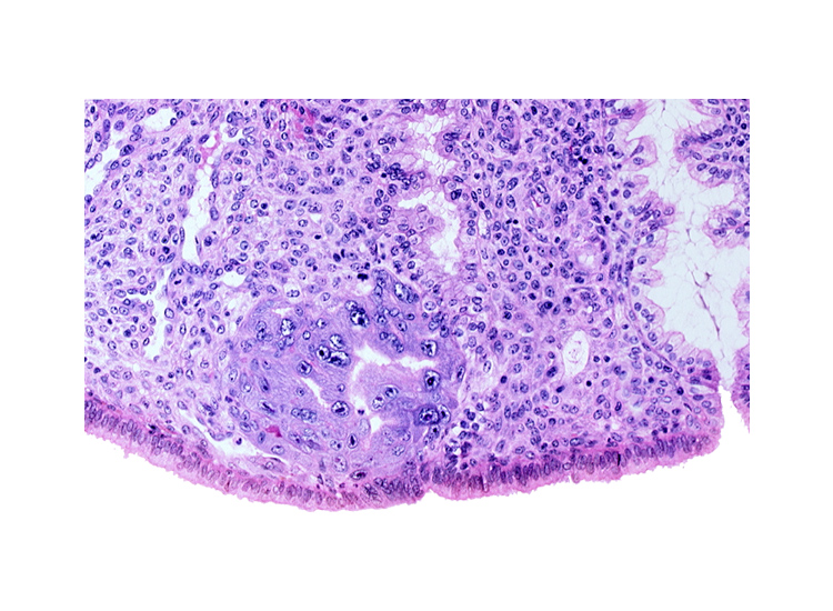 endometrial sinusoid, intact endometrial epithelium, lumen of endometrial gland, trophoblast lacunae, uterine cavity