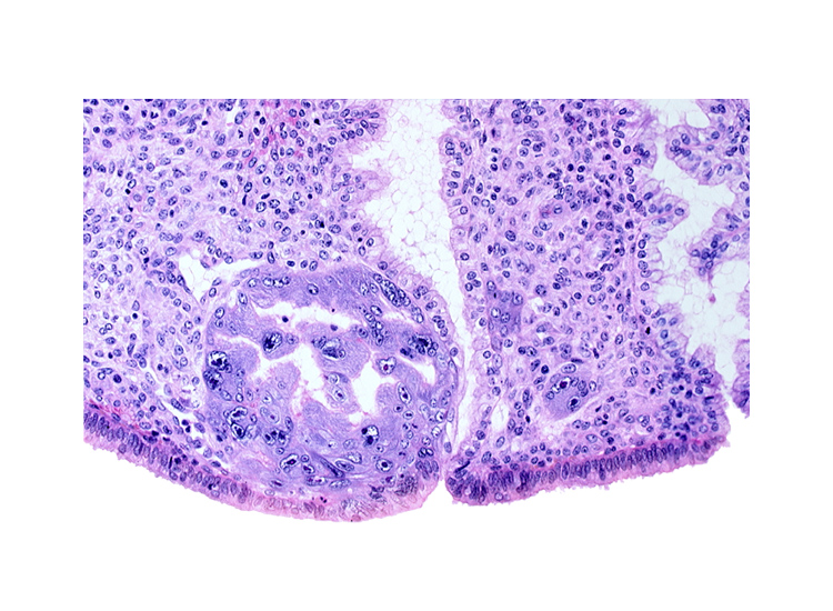 endometrial sinusoid, intact endometrial epithelium, intercommunicating lacunae, lumen of endometrial gland, mouth of endometrial gland, syncytiotrophoblast