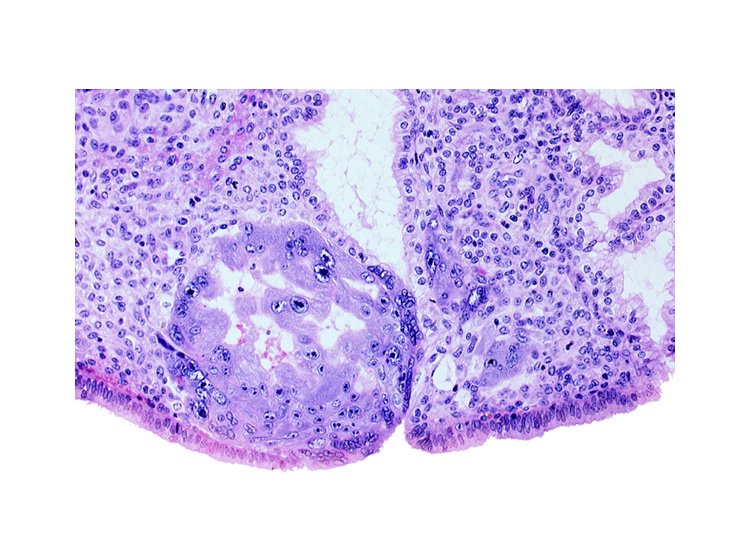 edematous endometrial stroma (decidua), edge of primary umbilical vesicle cavity, intact endometrial epithelium, intercommunicating lacunae, lumen of endometrial gland, mouth of endometrial gland, syncytiotrophoblast, uterine cavity